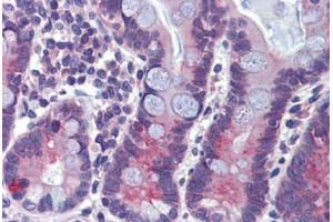 Human Small Intestine (formalin-fixed, paraffin-embedded) stained with ABCA5 antibody ABIN462240 followed by biotinylated goat anti-rabbit IgG secondary antibody ABIN481713, alkaline phosphatase-streptavidin and chromogen. (ABCA5 抗体  (AA 1296-1345))