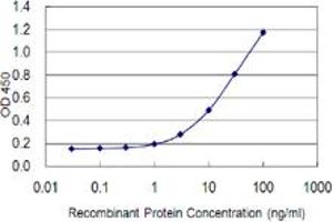 Detection limit for recombinant GST tagged ZNF100 is 0. (ZNF100 抗体  (AA 99-206))