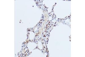Immunohistochemistry of paraffin-embedded rat lung using GLI1 Rabbit pAb (ABIN7271533) at dilution of 1:150 (40x lens).