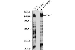 Immunoprecipitation analysis of 200 μg extracts of Jurkat cells using 3 μg CK antibody (ABIN6127628, ABIN6138647, ABIN6138648 and ABIN6224627). (CKAP5 抗体  (AA 1763-2032))