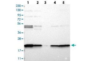 Western blot analysis of Lane 1: RT-4, Lane 2: U-251 MG, Lane 3: Human Plasma, Lane 4: Liver, Lane 5: Tonsil with TMEM109 polyclonal antibody  at 1:250-1:500 dilution. (TMEM109 抗体)