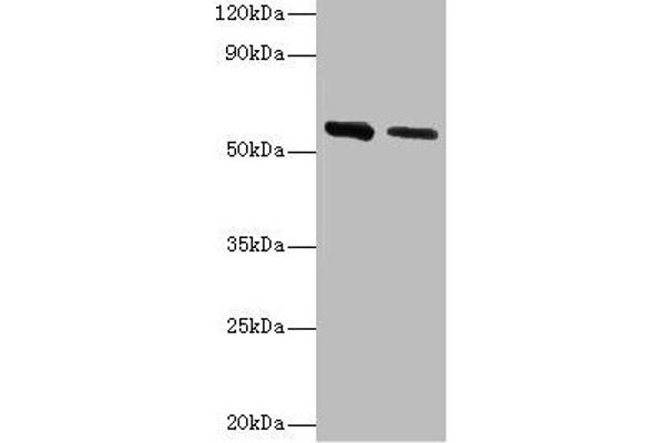 Adenylosuccinate Lyase 抗体  (AA 1-310)