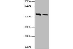 Western blot All lanes: ADSL antibody at 2 μg/mL Lane 1: Hela whole cell lysate Lane 2: Mouse heart tissue Secondary Goat polyclonal to rabbit IgG at 1/10000 dilution Predicted band size: 55, 49 kDa Observed band size: 55 kDa (Adenylosuccinate Lyase 抗体  (AA 1-310))