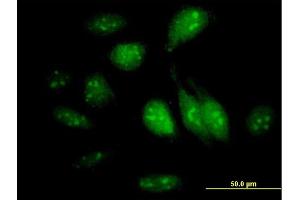 Immunofluorescence of purified MaxPab antibody to GTPBP4 on HeLa cell. (GTPBP4 抗体  (AA 1-634))
