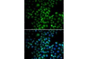 Immunofluorescence analysis of HeLa cells using C11orf30 antibody (ABIN6127845, ABIN6137722, ABIN6137724 and ABIN6217721). (EMSY 抗体  (AA 1153-1322))