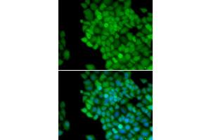 Immunofluorescence analysis of HeLa cells using MAGE-1/MA antibody (ABIN6132325, ABIN6143435, ABIN6143436 and ABIN6221133). (MAGEA1 抗体  (AA 1-309))