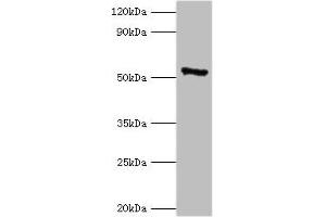 Western blot All lanes: CAMK4 antibody at 2 μg/mL + 293T whole cell lysate Secondary Goat polyclonal to rabbit IgG at 1/10000 dilution Predicted band size: 52 kDa Observed band size: 52 kDa (CAMK4 抗体  (AA 304-473))