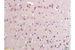 Formalin-fixed and paraffin embedded rat brain labeled with Anti-PRL Polyclonal Antibody, Unconjugated (ABIN669456) at 1:200 followed by conjugation to the secondary antibody and DAB staining. (Prolactin 抗体  (AA 165-227))