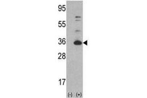 Western blot analysis of CDK4 antibody and 293 cell lysate (2 ug/lane) either nontransfected (Lane 1) or transiently transfected with the CDK4 gene (2).