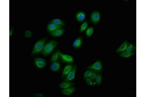 Immunofluorescence staining of HepG2 cells with ABIN7127737 at 1:100,counter-stained with DAPI. (Recombinant RAF1 抗体  (pSer259))