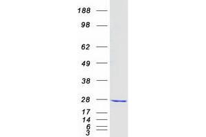Western Blotting (WB) image for Copper Metabolism (Murr1) Domain Containing 1 (COMMD1) protein (Myc-DYKDDDDK Tag) (ABIN2712441)