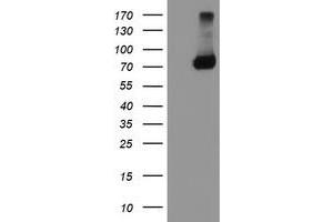 Western Blotting (WB) image for anti-TNF Receptor-Associated Protein 1 (TRAP1) antibody (ABIN1501500) (TRAP1 抗体)