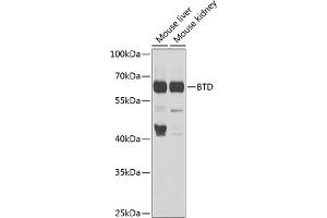 Western blot analysis of extracts of various cell lines, using BTD antibody (ABIN6127510, ABIN6137680, ABIN6137682 and ABIN6221882) at 1:1000 dilution. (BTD 抗体  (AA 284-543))
