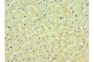 Immunohistochemistry of paraffin-embedded human liver tissue using ABIN7145506 at dilution of 1:100 (Glucuronidase beta 抗体  (AA 382-651))