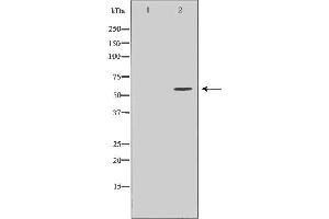 Western blot analysis of MCF7 cell lysate, using CDC25A Antibody. (CDC25A 抗体  (N-Term))