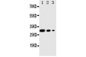 Lane 3: Recombinant Human CRTC1 Protein 2. (CRTC1 抗体  (C-Term))