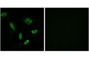 Immunofluorescence analysis of A549 cells, using SLC27A5 Antibody. (SLC27A5 抗体  (AA 481-530))