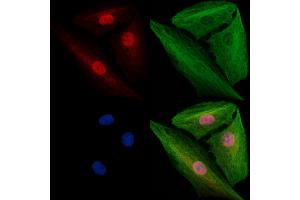 ABIN7094796 and ABIN7098847 staining  cells by IF/ICC. (SF3B1 抗体  (N-Term))