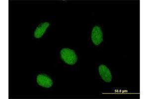 Immunofluorescence of purified MaxPab antibody to SAP30 on HeLa cell. (SAP30 抗体  (AA 1-220))