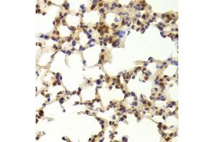 Immunohistochemistry of paraffin-embedded mouse lung using TAF1C Antibody. (TAF1C 抗体  (AA 70-320))