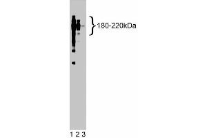 Western blot analysis of CD45 on a Jurkat cell lysate (Human T-cell leukemia, ATCC TIB-152). (CD45 抗体  (AA 535-730))