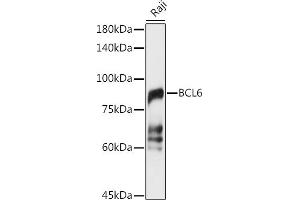 Western blot analysis of extracts of Raji cells, using BCL6 antibody (ABIN6130002, ABIN6137511, ABIN6137512 and ABIN6222987) at 1:1000 dilution. (BCL6 抗体  (AA 1-280))