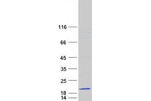 Western Blotting (WB) image for Ribosomal Protein S14 (RPS14) (Transcript Variant 2) protein (Myc-DYKDDDDK Tag) (ABIN2731160)