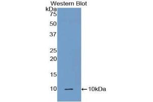 Detection of Recombinant C5a, Mouse using Polyclonal Antibody to Complement Component 5a (C5a) (C5A 抗体  (AA 679-755))