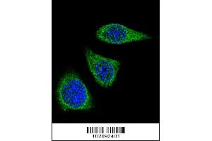 Confocal immunofluorescent analysis of MMP7 Antibody with 293 cell followed by Alexa Fluor 488-conjugated goat anti-rabbit lgG (green). (MMP7 抗体  (AA 117-146))