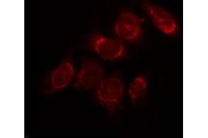 ABIN6268944 staining Hela by IF/ICC. (VDAC2 抗体)
