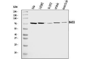 Western blot analysis of BACE1 using anti-BACE1 antibody (ABIN7600383).