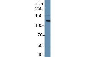 Western blot analysis of Mouse Serum, using Mouse LIFR Antibody (1 µg/ml) and HRP-conjugated Goat Anti-Rabbit antibody ( (LIFR 抗体  (AA 641-790))
