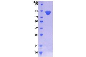 SDS-PAGE analysis of Human NOX5 Protein. (NOX5 蛋白)
