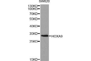 Western blot analysis of extracts of SW620 cell line, using HOXA9 antibody. (HOXA9 抗体  (AA 1-190))