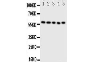 Anti-ERp57 antibody, Western blotting Lane 1: SMMC Cell Lysate Lane 2: A549 Cell Lysate Lane 3: U87 Cell Lysate Lane 4: HELA Cell Lysate Lane 5: MCF-7 Cell Lysate