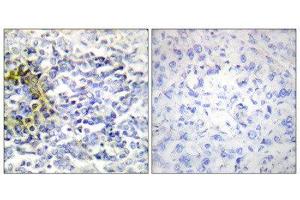 Immunohistochemistry (IHC) image for anti-Fragile X Mental Retardation, Autosomal Homolog 2 (FXR2) (C-Term) antibody (ABIN1849412) (FXR2 抗体  (C-Term))