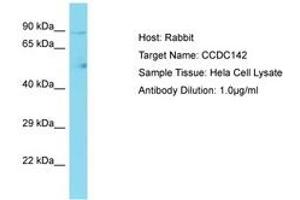 Image no. 1 for anti-Coiled-Coil Domain Containing 142 (CCDC142) (AA 658-707) antibody (ABIN6750704) (CCDC142 抗体  (AA 658-707))