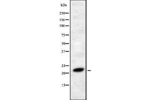 Western blot analysis FGF4 using RAW264. (FGF4 抗体  (Internal Region))