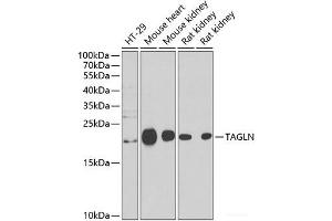 Western blot analysis of extracts of various cell lines using TAGLN Polyclonal Antibody at dilution of 1:1000. (Transgelin 抗体)