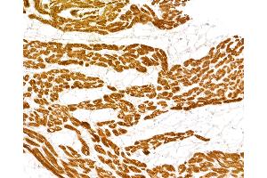 anti-Cardiac Troponin I (TNNI3) antibody
