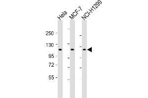 All lanes : Anti-P1R13L Antibody (Center) at 1:2000 dilution Lane 1: Hela whole cell lysates Lane 2: MCF-7 whole cell lysates Lane 3: NCI- whole cell lysates Lysates/proteins at 20 μg per lane. (PPP1R13L 抗体  (AA 455-485))