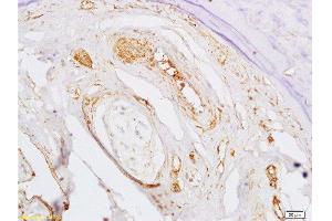 Formalin-fixed and paraffin embedded rat bone marrow labeled with Rabbit Anti BMPR1A/CD292 Polyclonal Antibody, Unconjugated  at 1:200 followed by conjugation to the secondary antibody and DAB staining