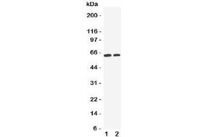 Western blot testing of OCT1 antibody and Lane 1:  HeLa;  2: A549 cell lysate. (SLC22A1 抗体  (C-Term))