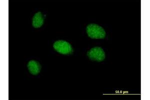 Immunofluorescence of purified MaxPab antibody to CDYL2 on HeLa cell. (CDYL2 抗体  (AA 1-506))