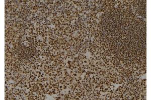 ABIN6274017 at 1/100 staining Mouse spleen tissue by IHC-P. (H2AFZ 抗体)