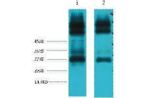 Western Blotting (WB) image for anti-EF-Hand Domain Family, Member D1 (EFHD1) antibody (ABIN3181155)