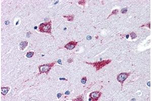Human Brain, Cortex (formalin-fixed, paraffin-embedded) stained with ALS2 antibody ABIN351462 at 3. (ALS2 抗体  (AA 1644-1657))