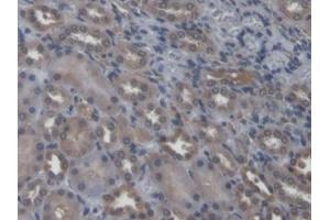 DAB staining on IHC-P; Samples: Rat Kidney Tissue (NEU2 抗体  (AA 185-379))