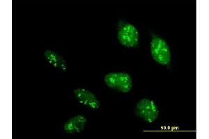 Immunofluorescence of purified MaxPab antibody to POLR1D on HeLa cell. (POLR1D 抗体  (AA 1-133))
