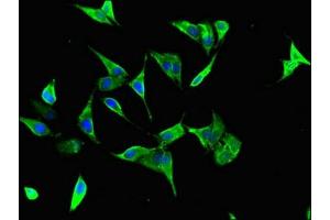 Immunofluorescent analysis of Hela cells using ABIN7155909 at dilution of 1:100 and Alexa Fluor 488-congugated AffiniPure Goat Anti-Rabbit IgG(H+L) (HCFC1 抗体  (AA 201-428))